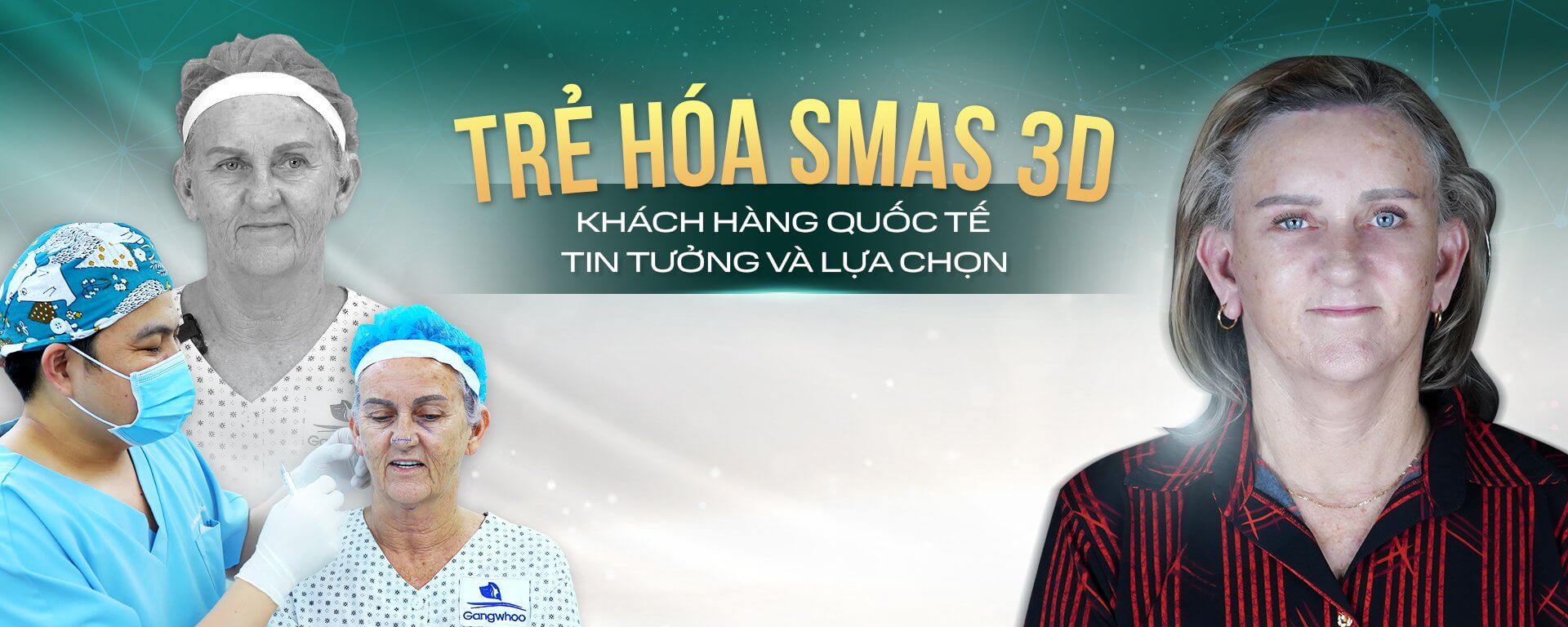 LDP cang da mat bscuong PC 1 1