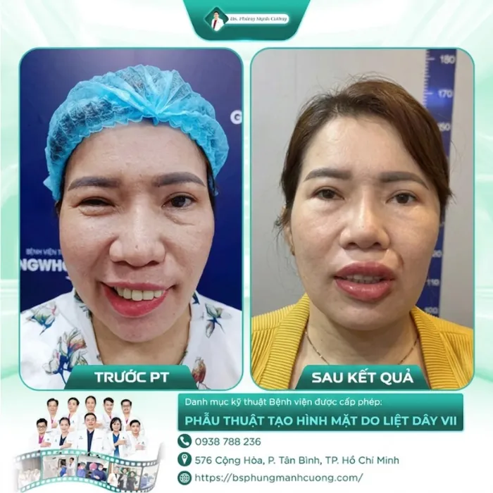 Hình Ảnh Khách Hàng Liệt Mặt