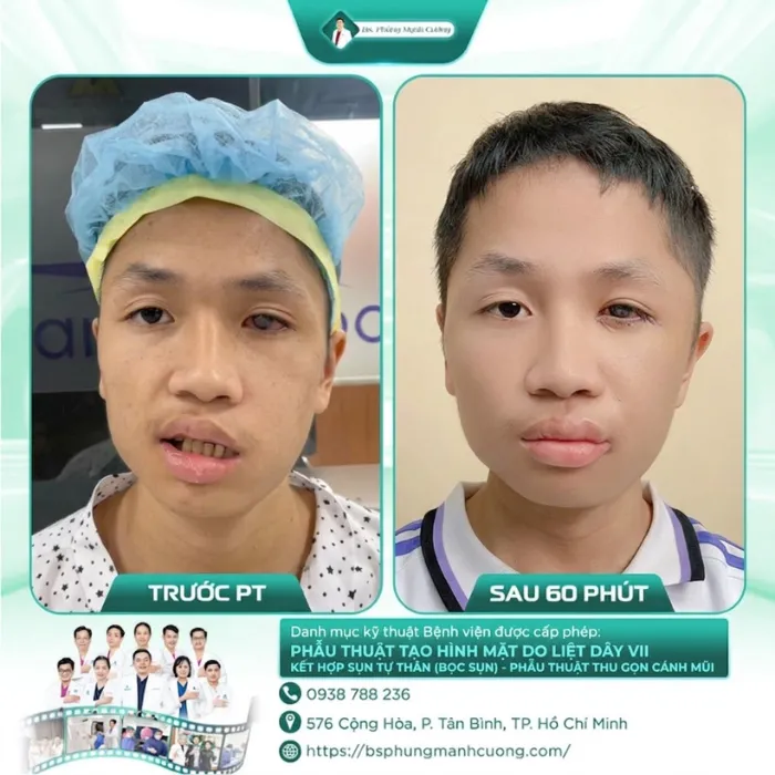 Hình Ảnh Khách Hàng Liệt Mặt