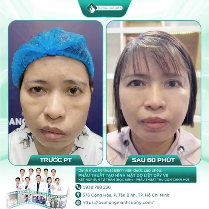 Hình Ảnh Khách Hàng Liệt Mặt