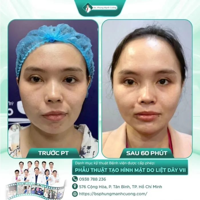 Hình Ảnh Khách Hàng Liệt Mặt