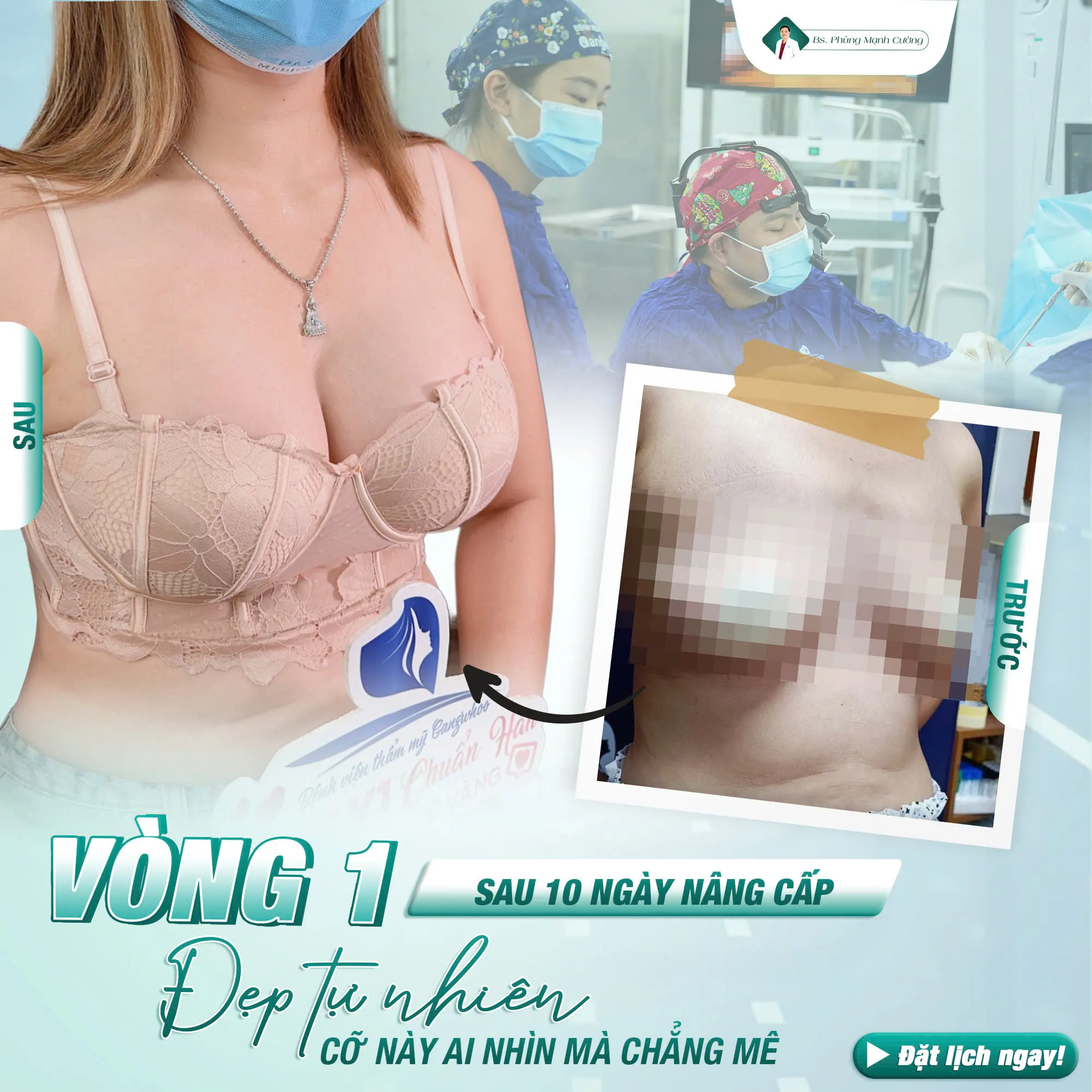 Bí quyết nâng ngực đẹp tự nhiên tại Bác sĩ Phùng Mạnh Cường