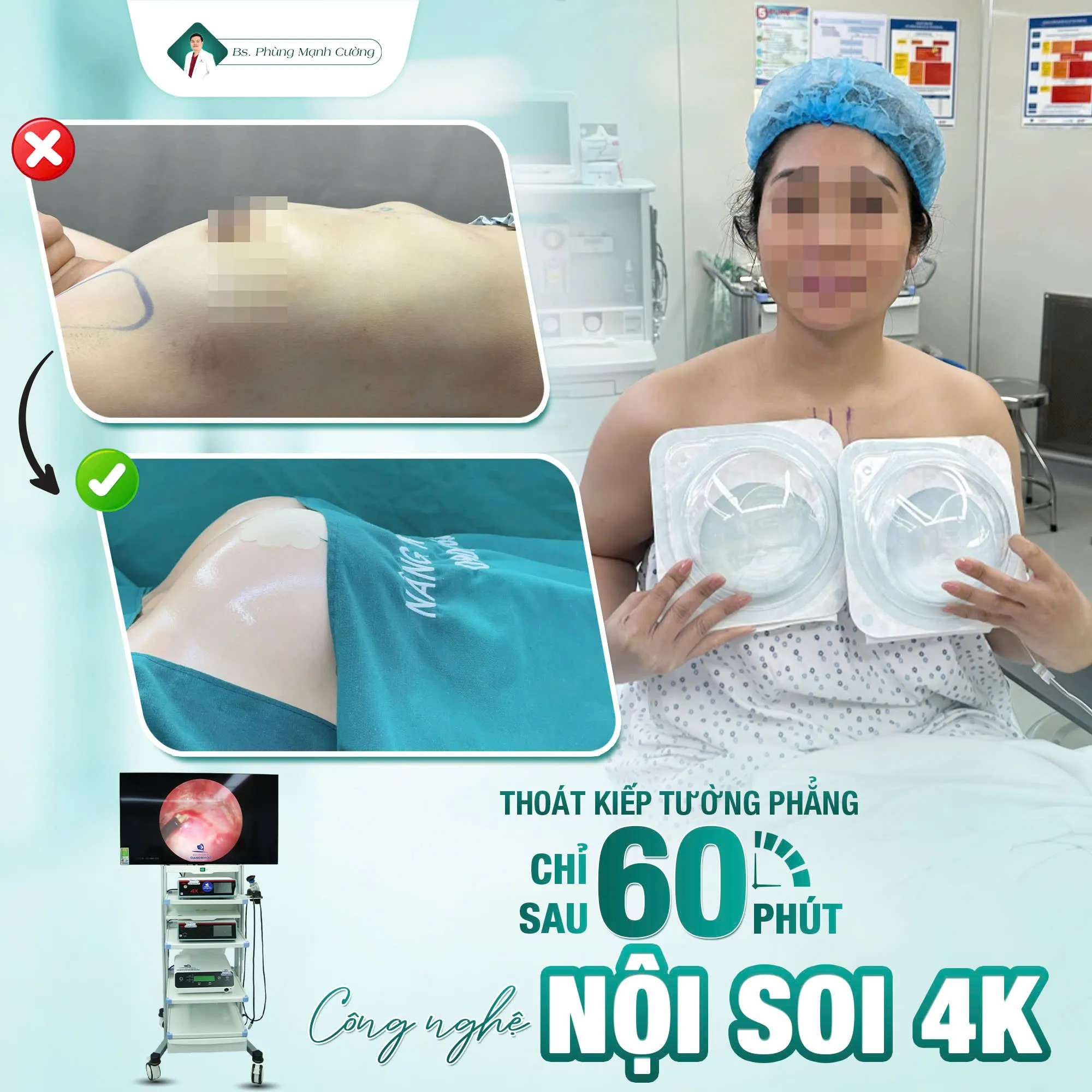 Bí quyết nâng ngực đẹp tự nhiên tại Bác sĩ Phùng Mạnh Cường