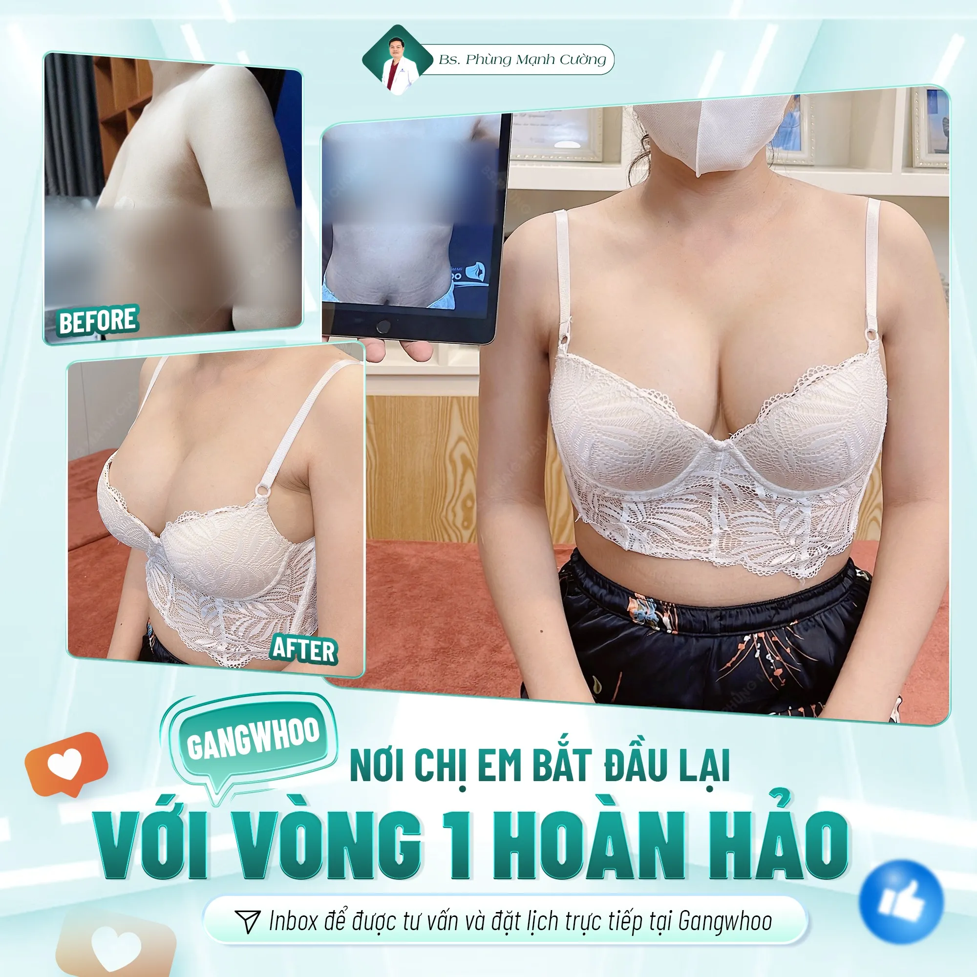 Bí quyết nâng ngực đẹp tự nhiên tại Bác sĩ Phùng Mạnh Cường