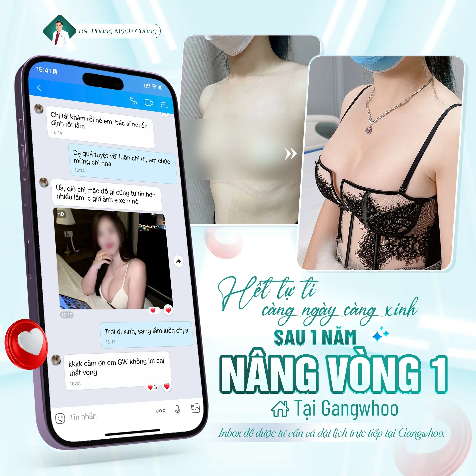 Bí quyết nâng ngực đẹp tự nhiên tại Bác sĩ Phùng Mạnh Cường