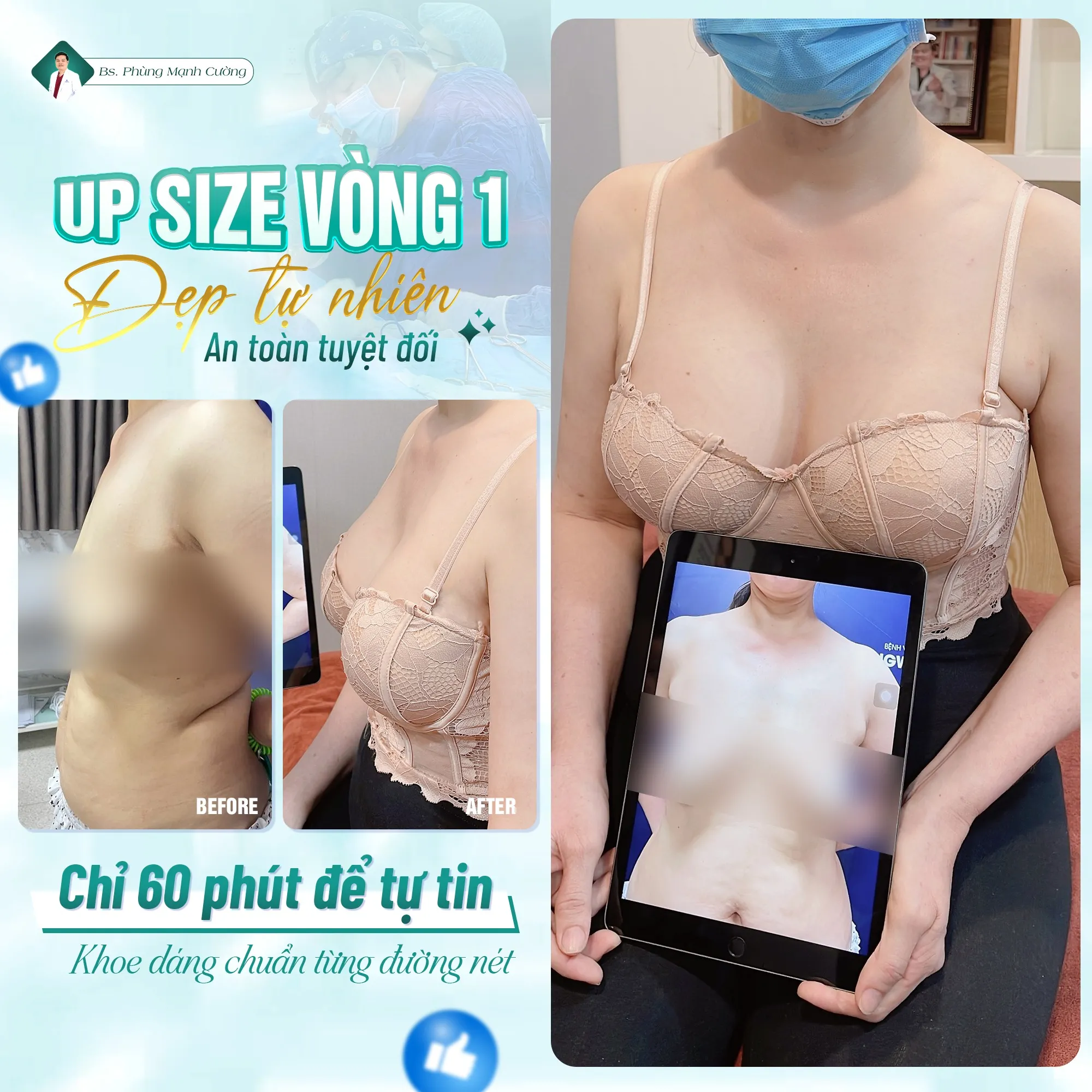 Bí quyết nâng ngực đẹp tự nhiên tại Bác sĩ Phùng Mạnh Cường