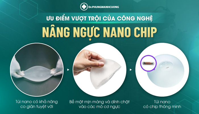 Ưu điểm vượt trội của công nghệ nâng ngực nano chip
