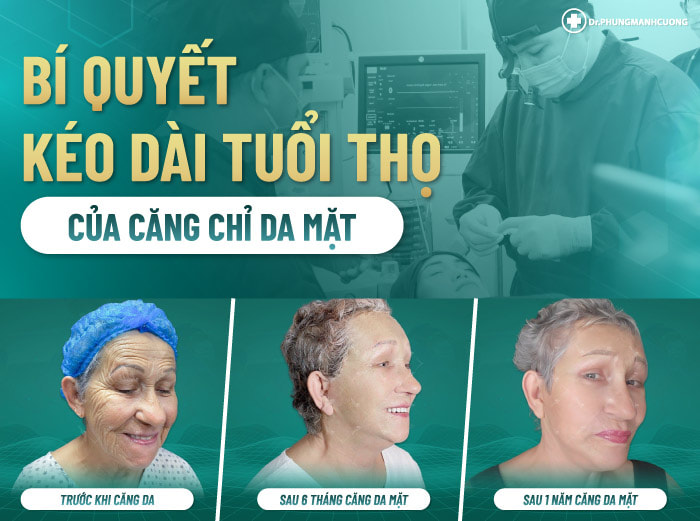 Làm gì để kéo dài "tuổi thọ" căng da mặt? Tìm hiểu ngay!