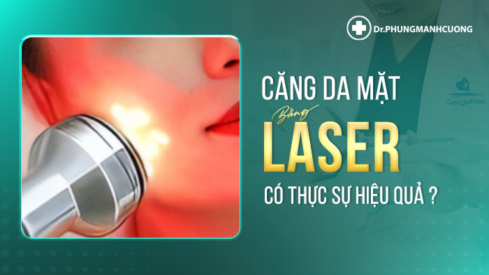 Căng da mặt bằng laser là phương pháp trẻ hóa da sử dụng công nghệ laser để kích thích tổ chức dưới da tái tạo collagen