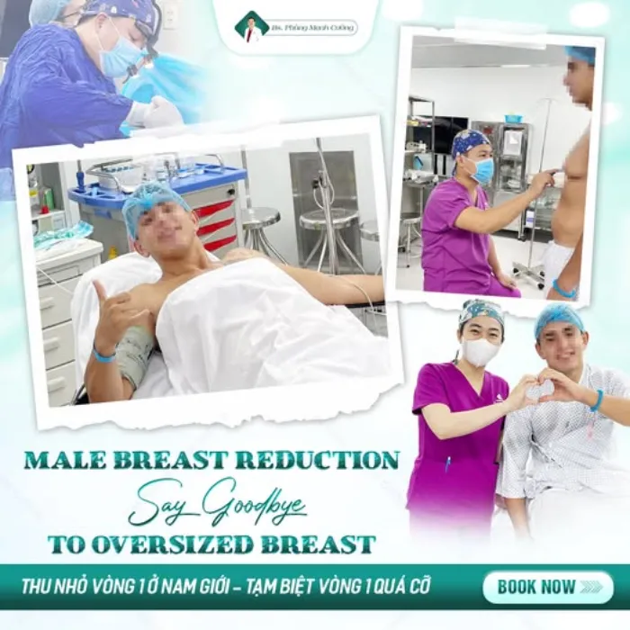 Cắt tuyến vú là gì? Lưu ý trước và sau khi cắt tuyến vú