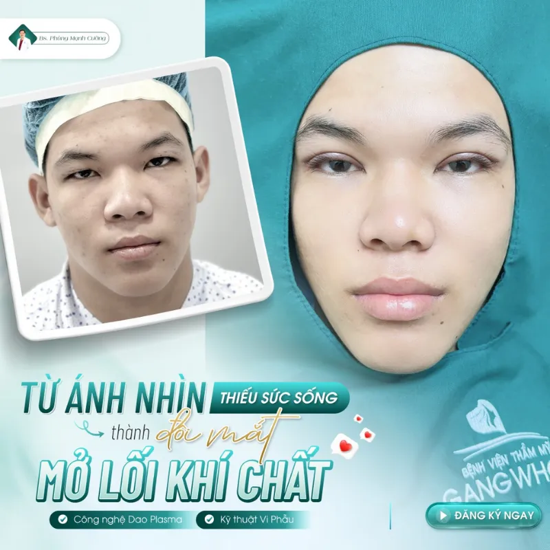 Cắt mí nam là gì? Cắt mắt 2 mí cho nam giới giá bao nhiêu? 27 Nam giới từ 18 tuổi trở lên có thể cắt mí