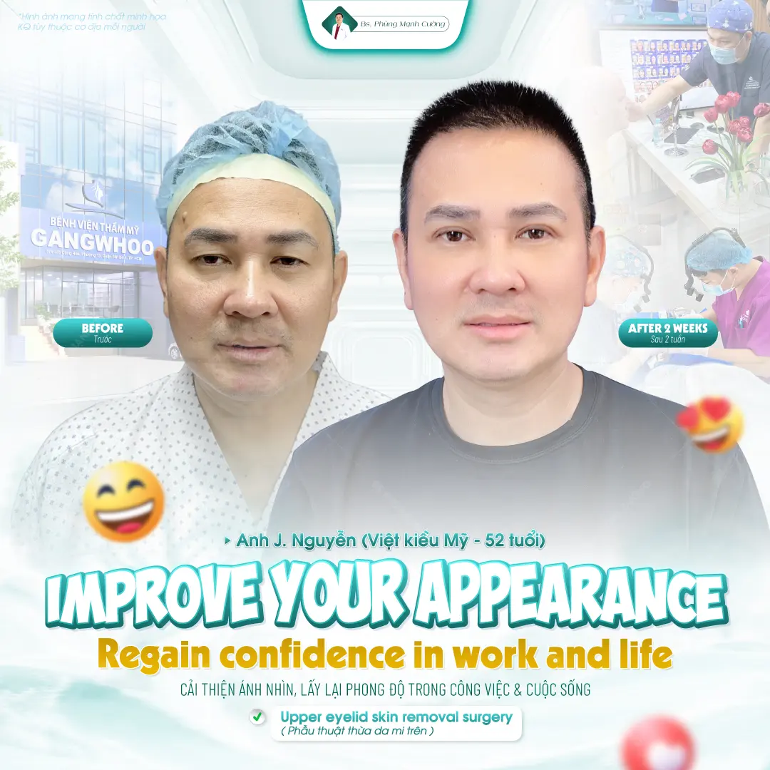 Khác biệt giữa cắt mí nam và nữ