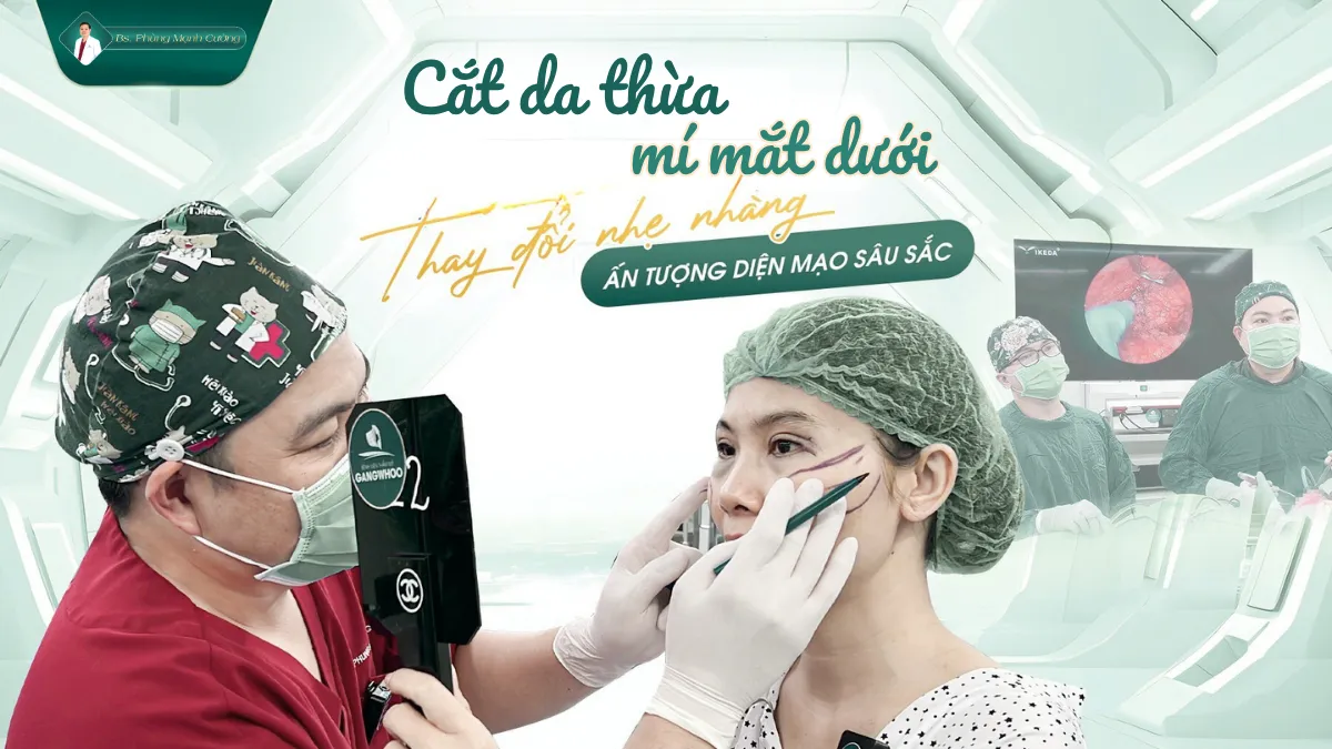 Phẫu thuật cắt da thừa mí mắt và những điều cần biết 19 Cắt da dư mí mắt loại bỏ nếp nhăn, chùng, nhão