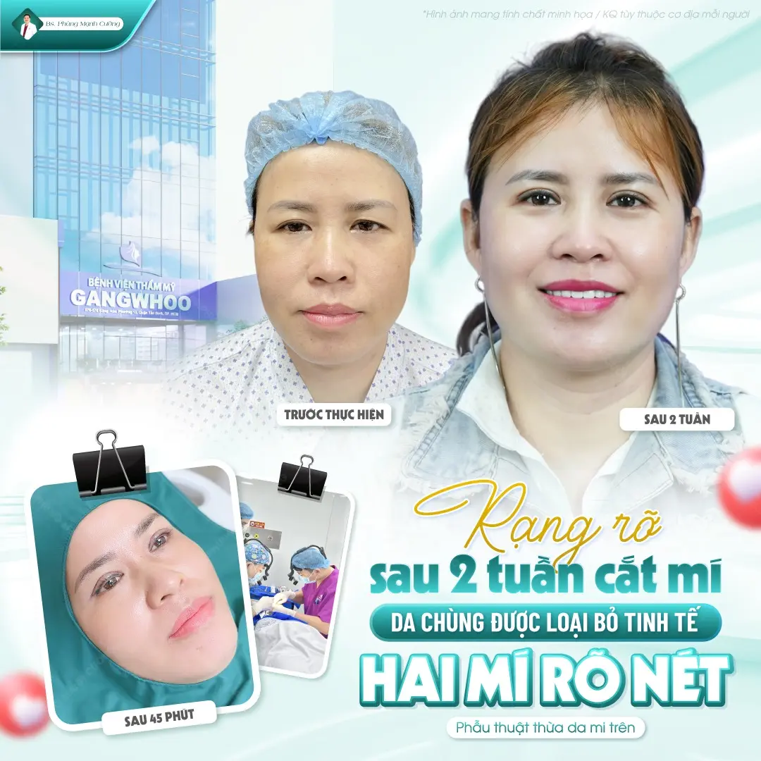 Tuân thủ chỉ dẫn của bác sĩ khi sử dụng thuốc chống sẹo