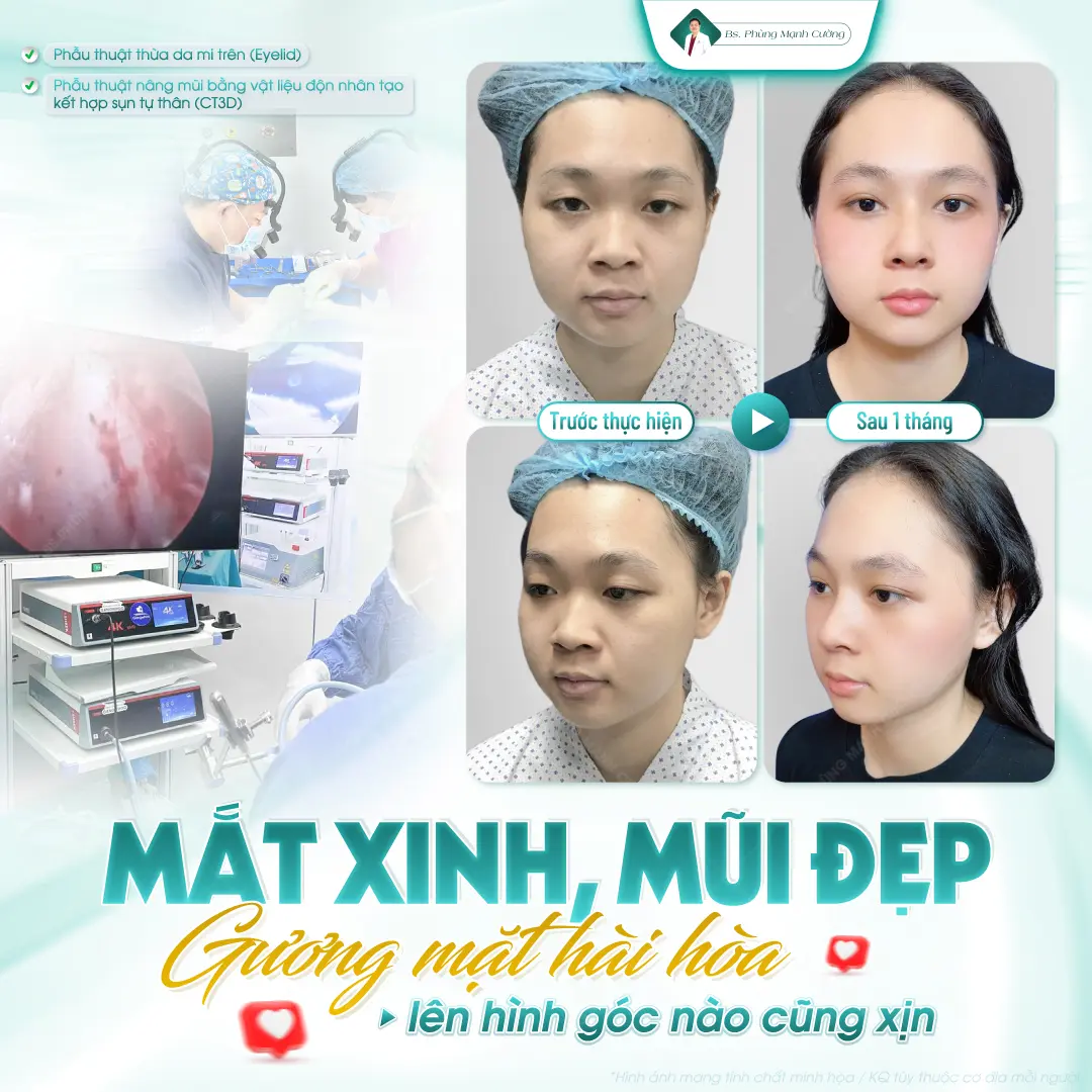 Nâng mũi và cắt mí rút ngắn thời gian nghỉ dưỡng