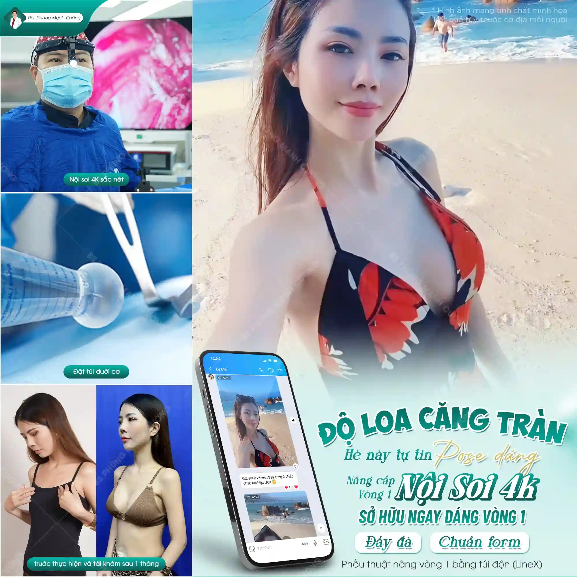 Áo định hình giúp ngực nhanh vào form