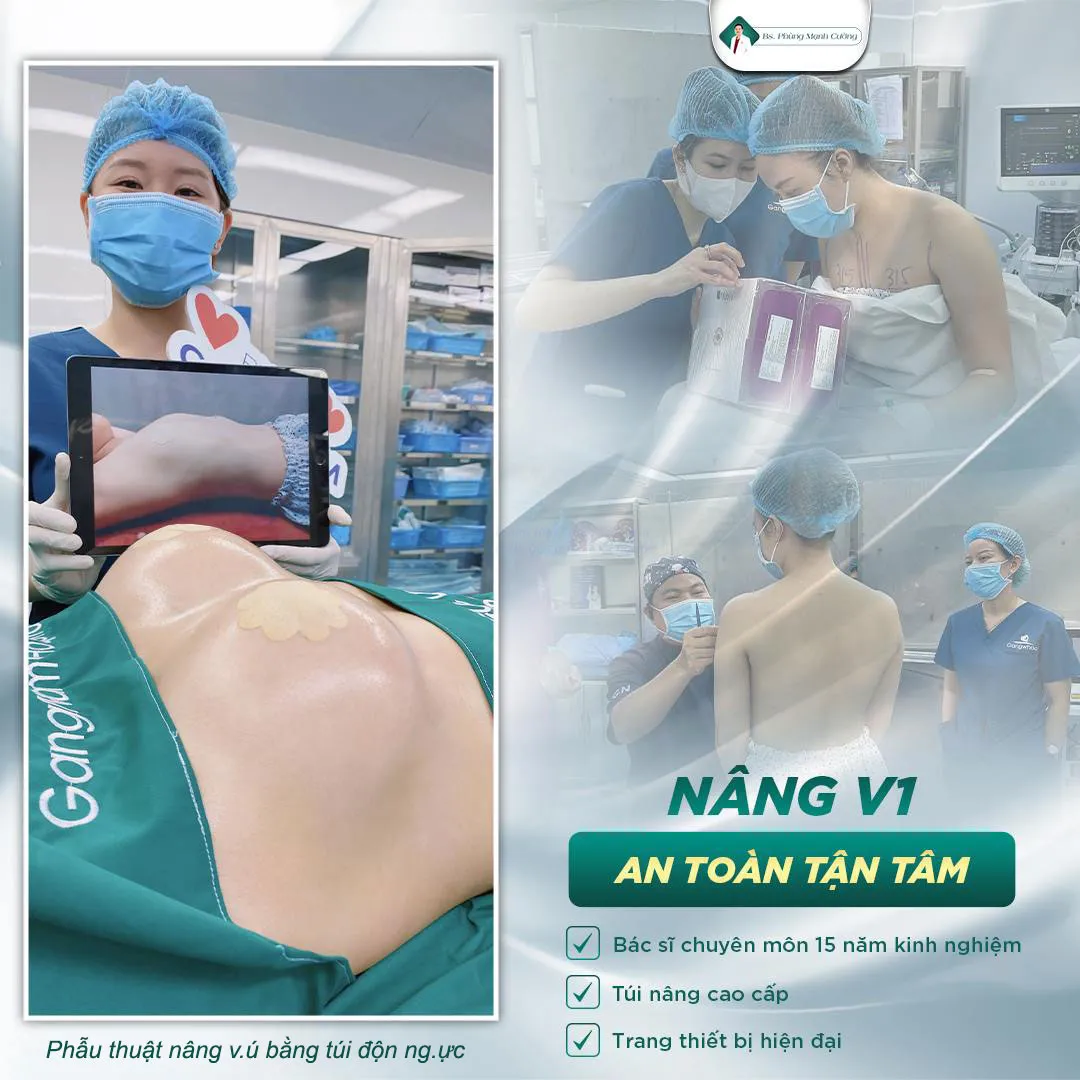 Bác sĩ tư vấn túi nâng ngực phù hợp trước khi thực hiện