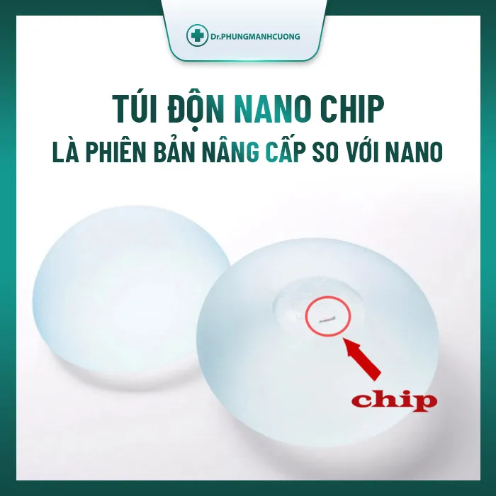 Nano Chip bên trong có chứa con chip chứa các thông số quan trọng của túi