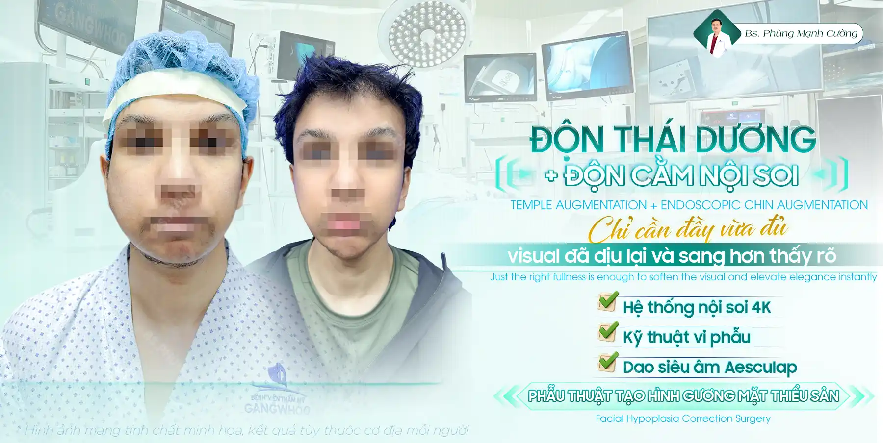 Tìm hiểu độn cằm có bị biến chứng khi về già không