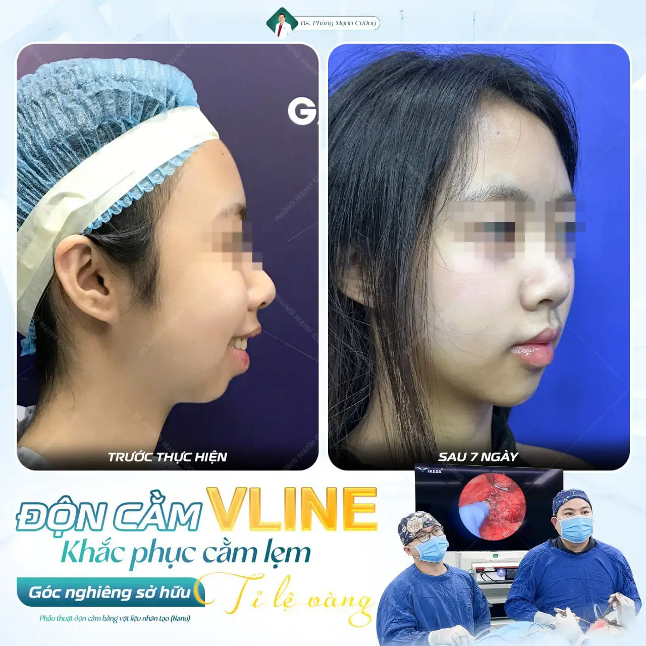 Bác sĩ Phùng Mạnh Cường - chuyên gia thẩm mỹ với hơn 15 năm kinh nghiệm