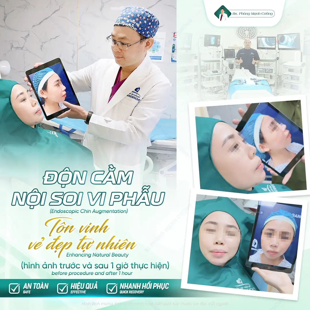 Có nên độn cằm không? Ưu điểm và đối tượng phù hợp 10 Tư vấn các trường hợp nên độn cằm