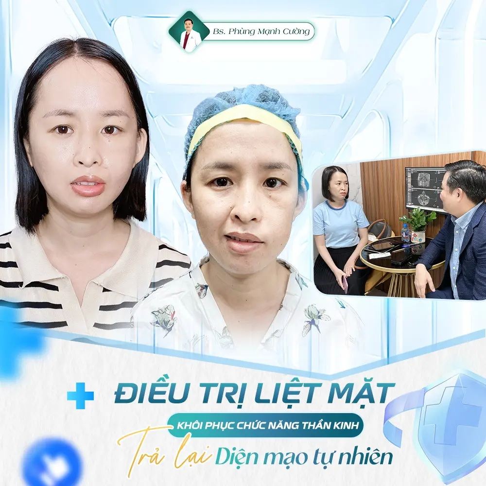 Các yếu tố ảnh hướng đến chi phí phẫu thuật liệt mặt ngoại biên