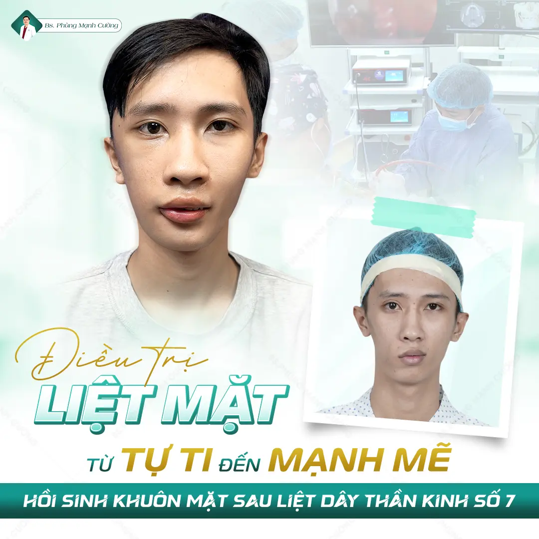 Các chi phí đã bao gồm trong phẫu thuật điều trị liệt mặt