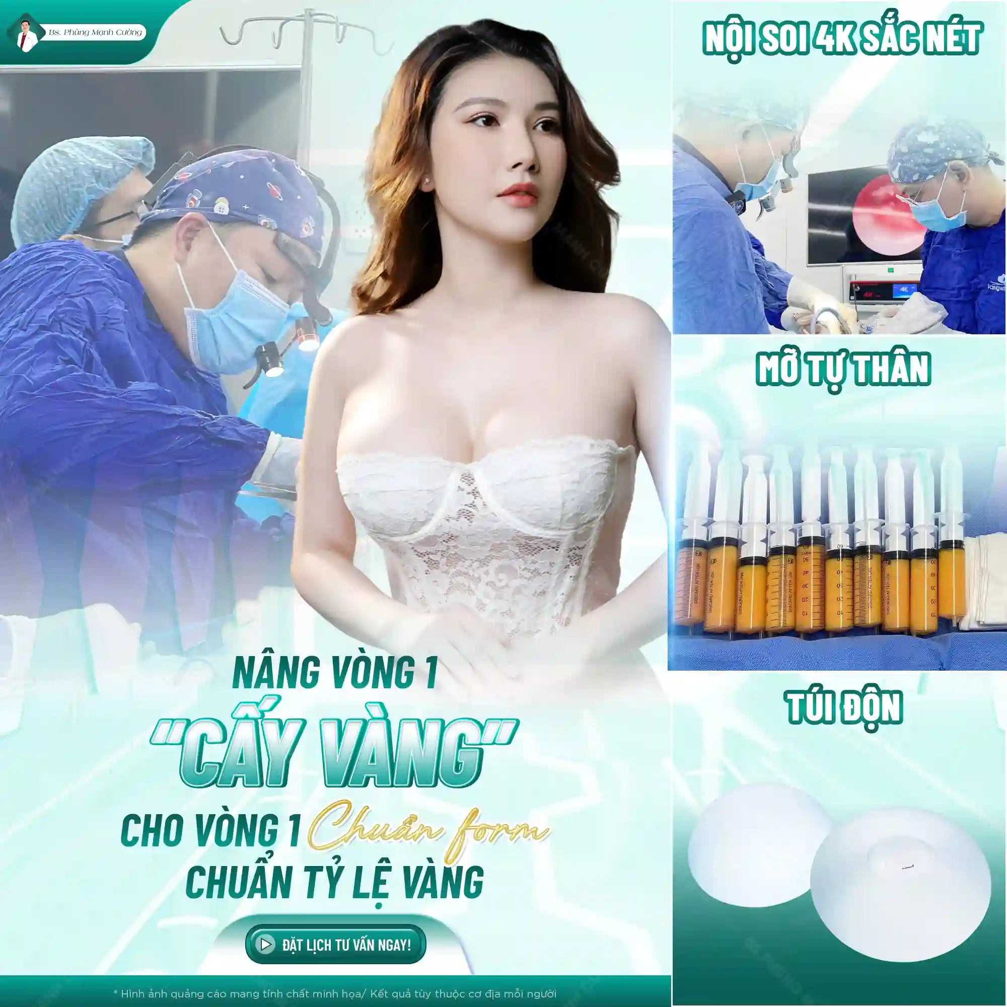 Những ai nên nâng ngực bằng mỡ tự thân?