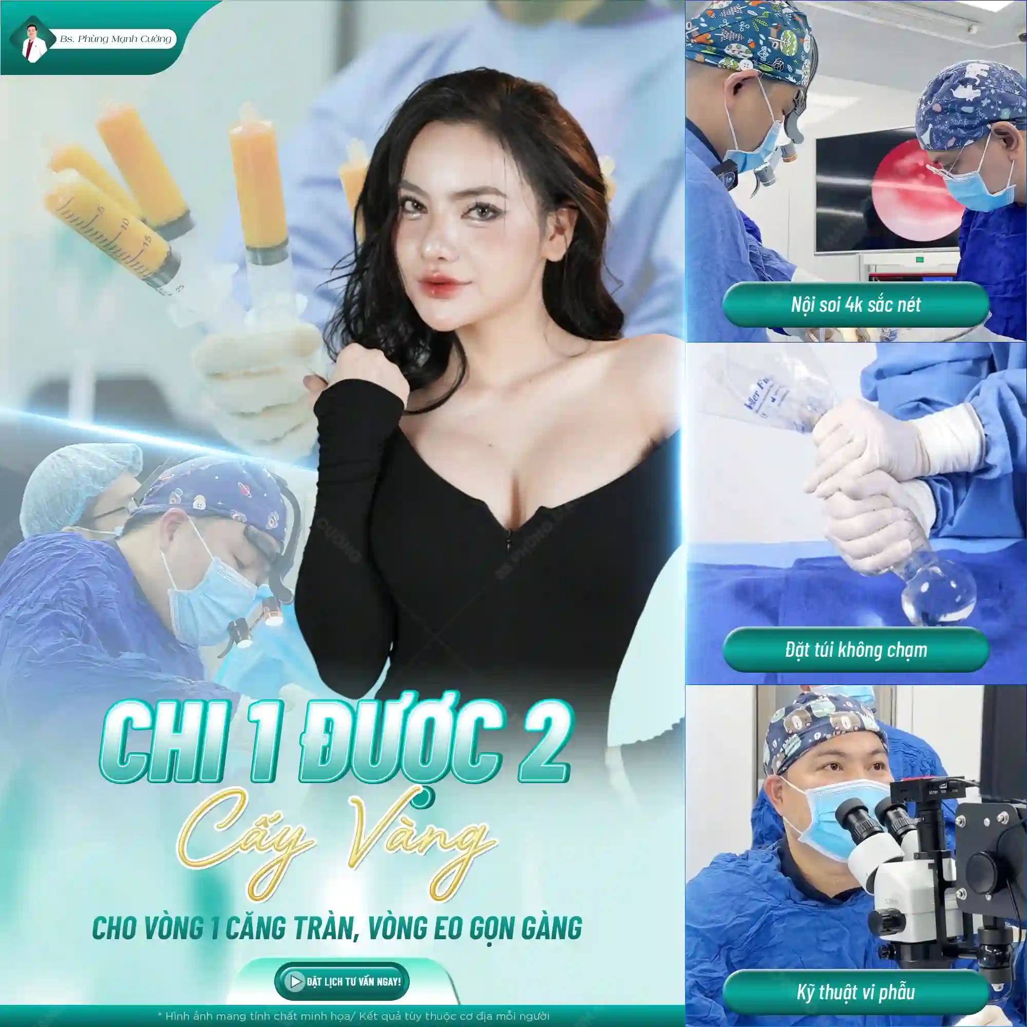 Tìm hiểu về phẫu thuật nâng ngực cấy mỡ tự thân