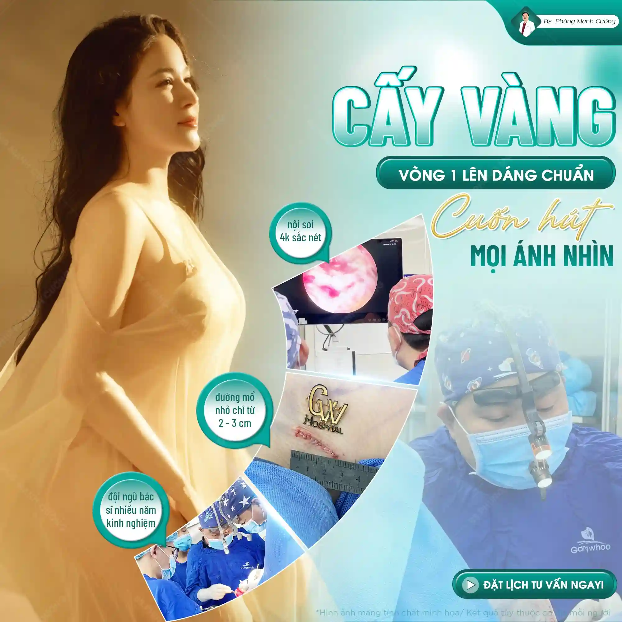 Chi phí nâng ngực bằng mỡ tự thân dao động từ 25 đến 40 triệu đồng