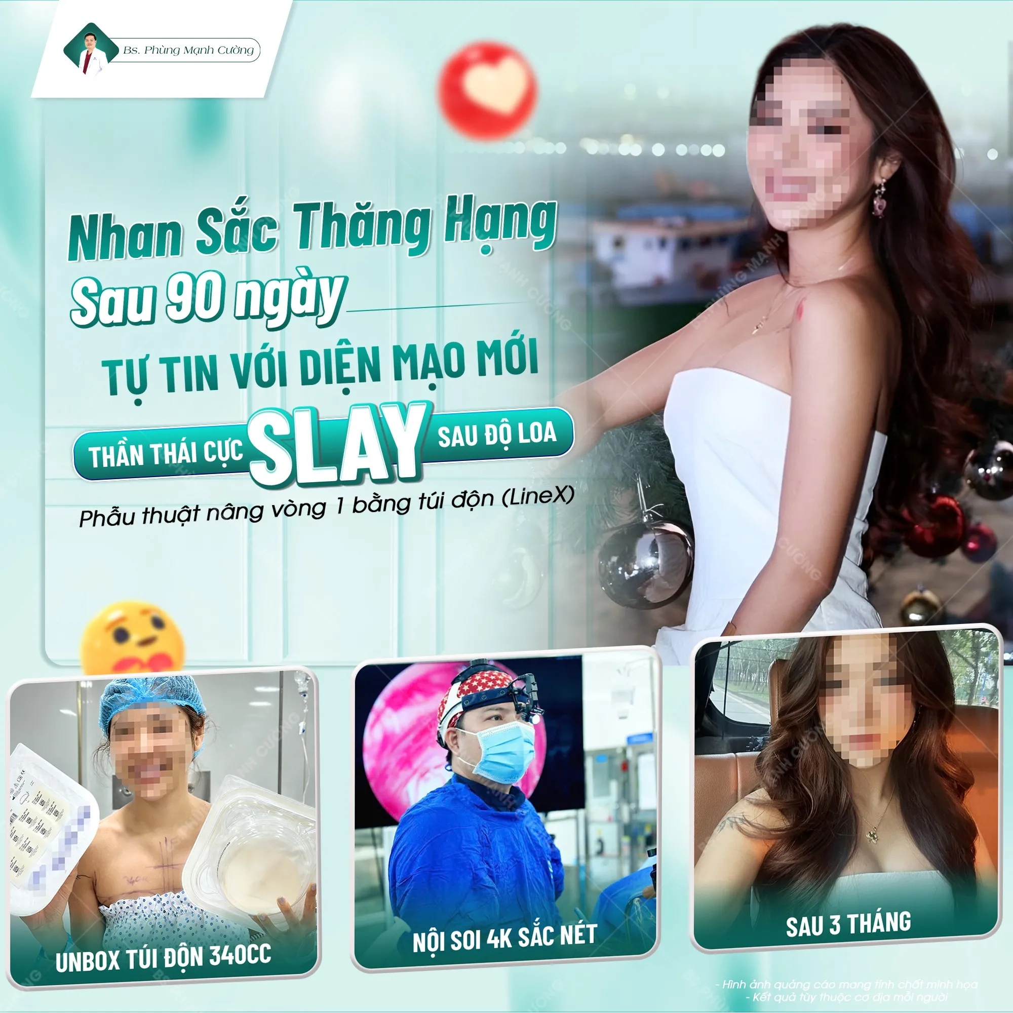 Thời gian hồi phục trung bình kéo dài khoảng 4 – 6 tuần