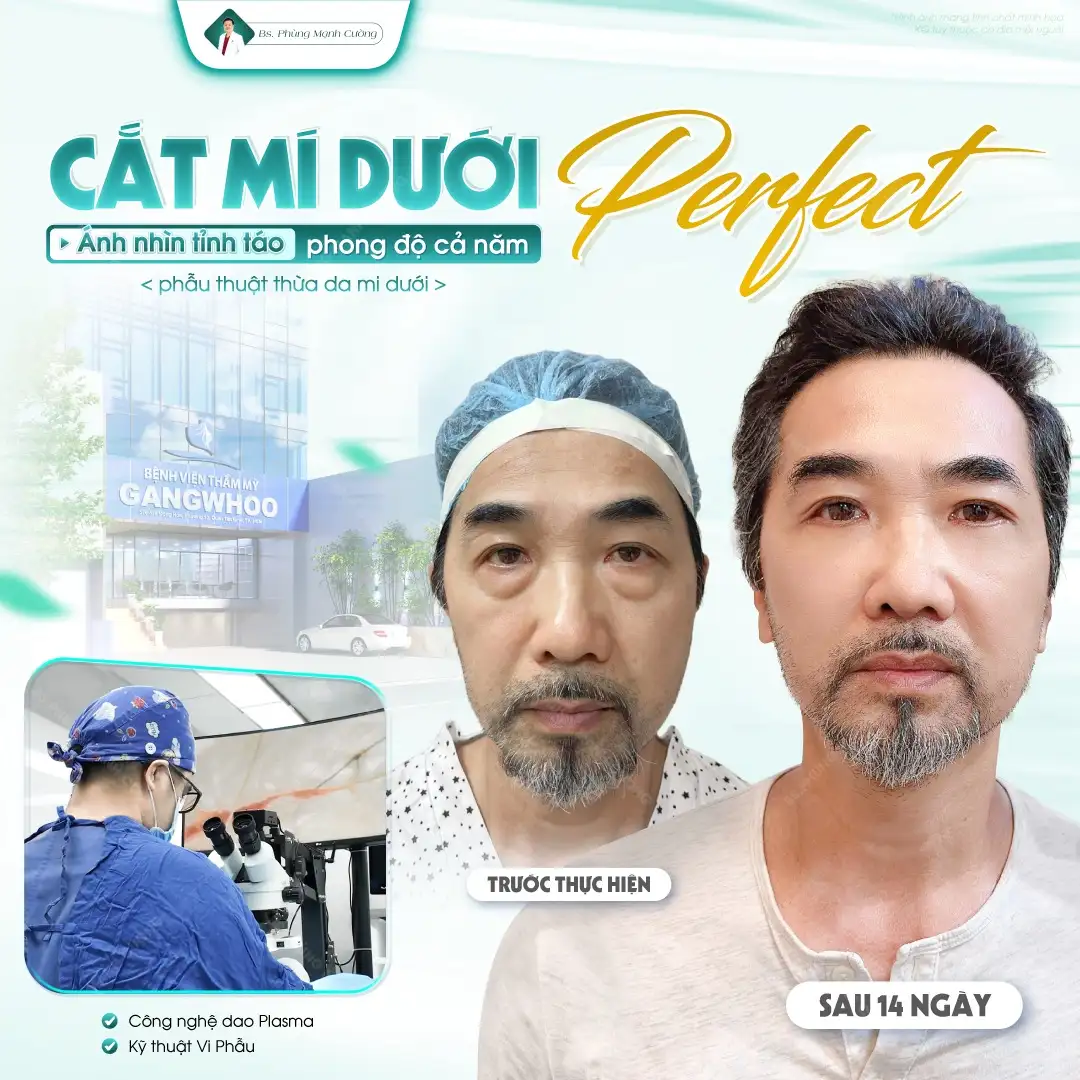 Các yếu tố ảnh hưởng đến giá cắt bọng mắt