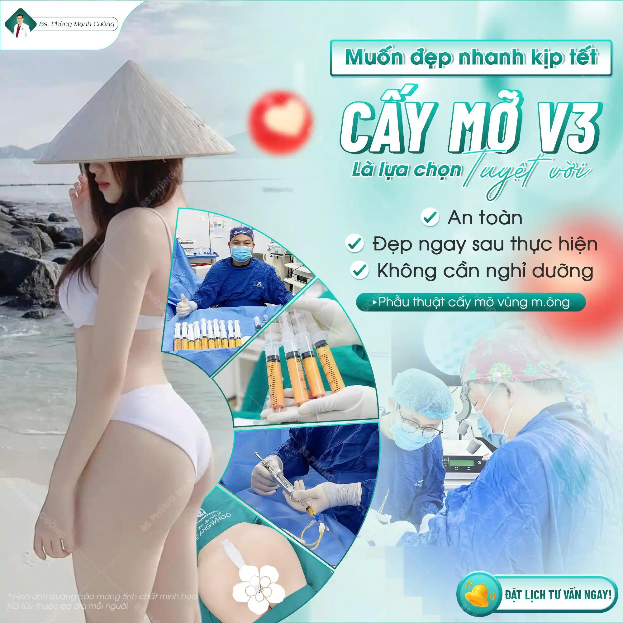 Nâng mông công nghệ cao là gì? Có những công nghệ nào? 26 Nâng mông công nghệ cao cùng bác sĩ Phùng Mạnh Cường