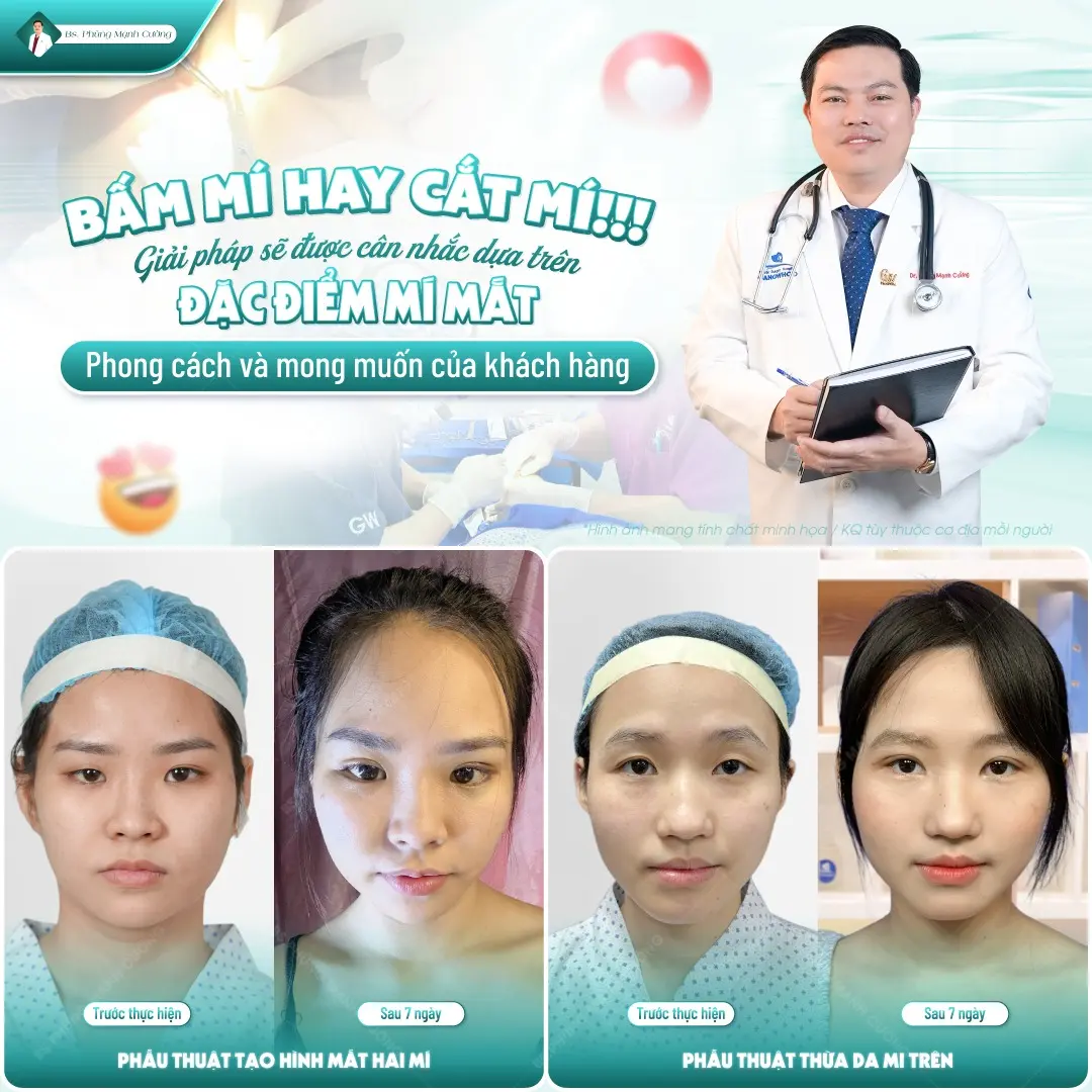 So sánh bấm mí và cắt mí khác nhau như thế nào