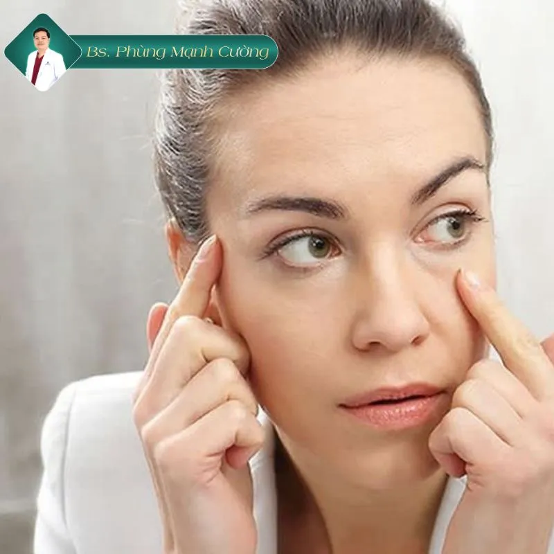 Cắt mí bị lệch có sửa được không? Sửa cắt mí lệch ở đâu? 12 Cách hạn chế nguy cơ cắt mí bị lệch