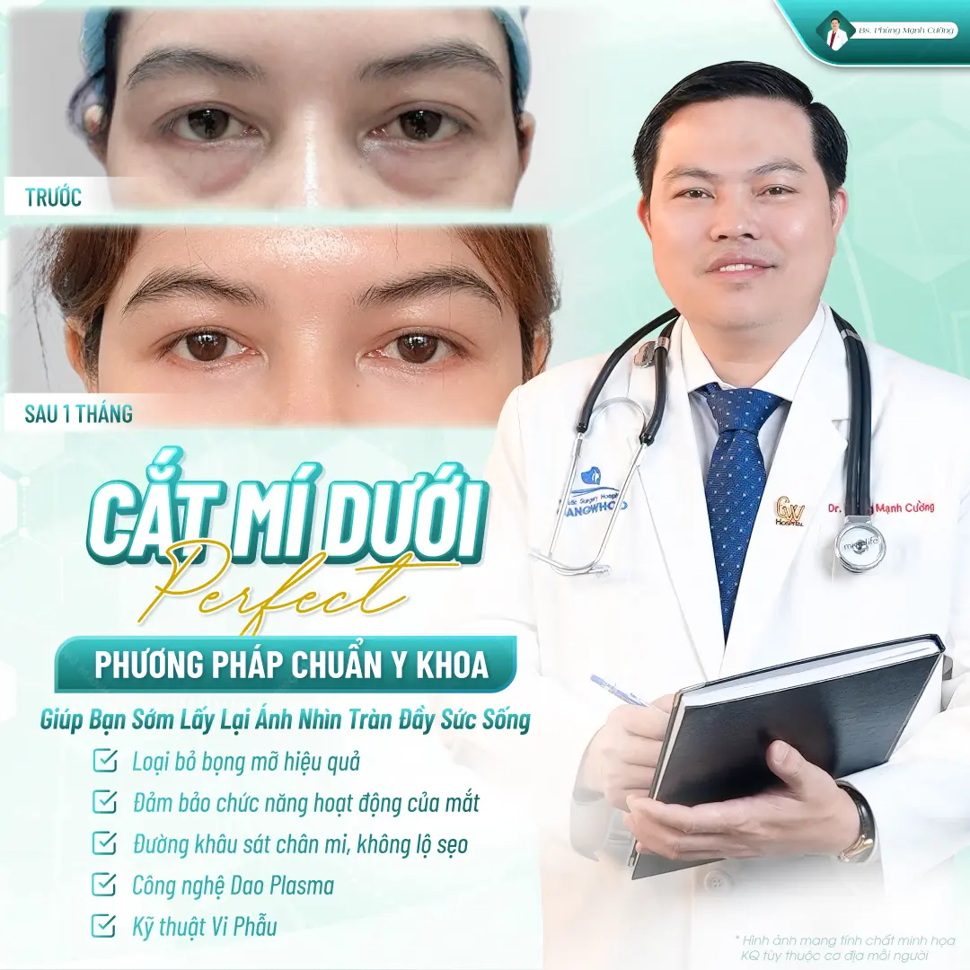 Cắt da thừa mí dưới giúp mang lại sự trẻ trung cho đôi mắt