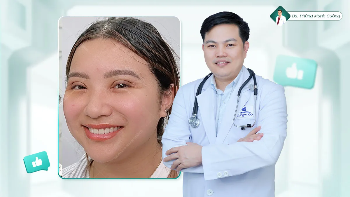 Cắt mí size bao nhiêu là đẹp