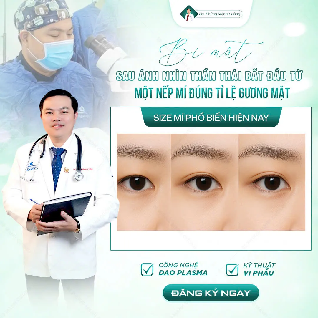 Tư vấn cắt mí size bao nhiêu đẹp