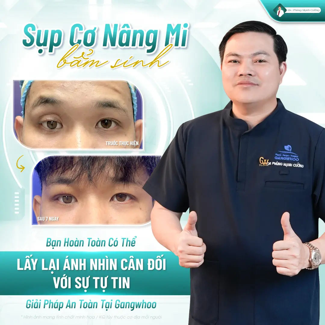 Phẫu thuật sụp mí mắt giá bao nhiêu tùy thuộc vào tay nghề của bác sĩ