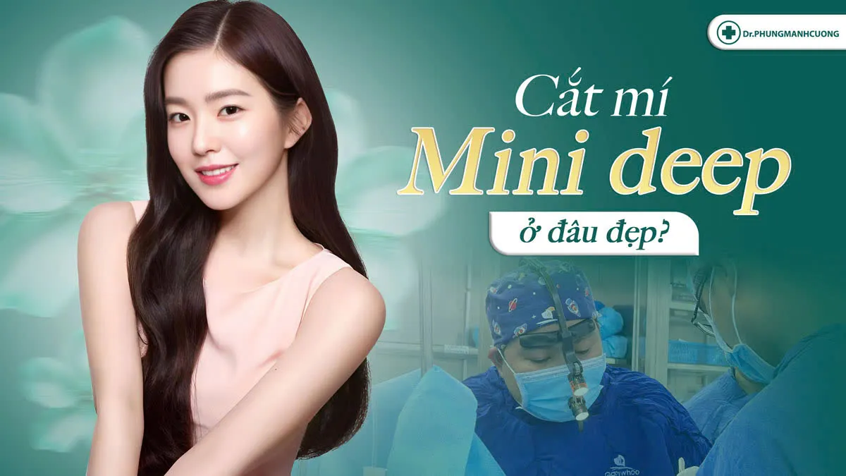 Tìm hiểu cắt mí mini deep ở đâu đẹp​