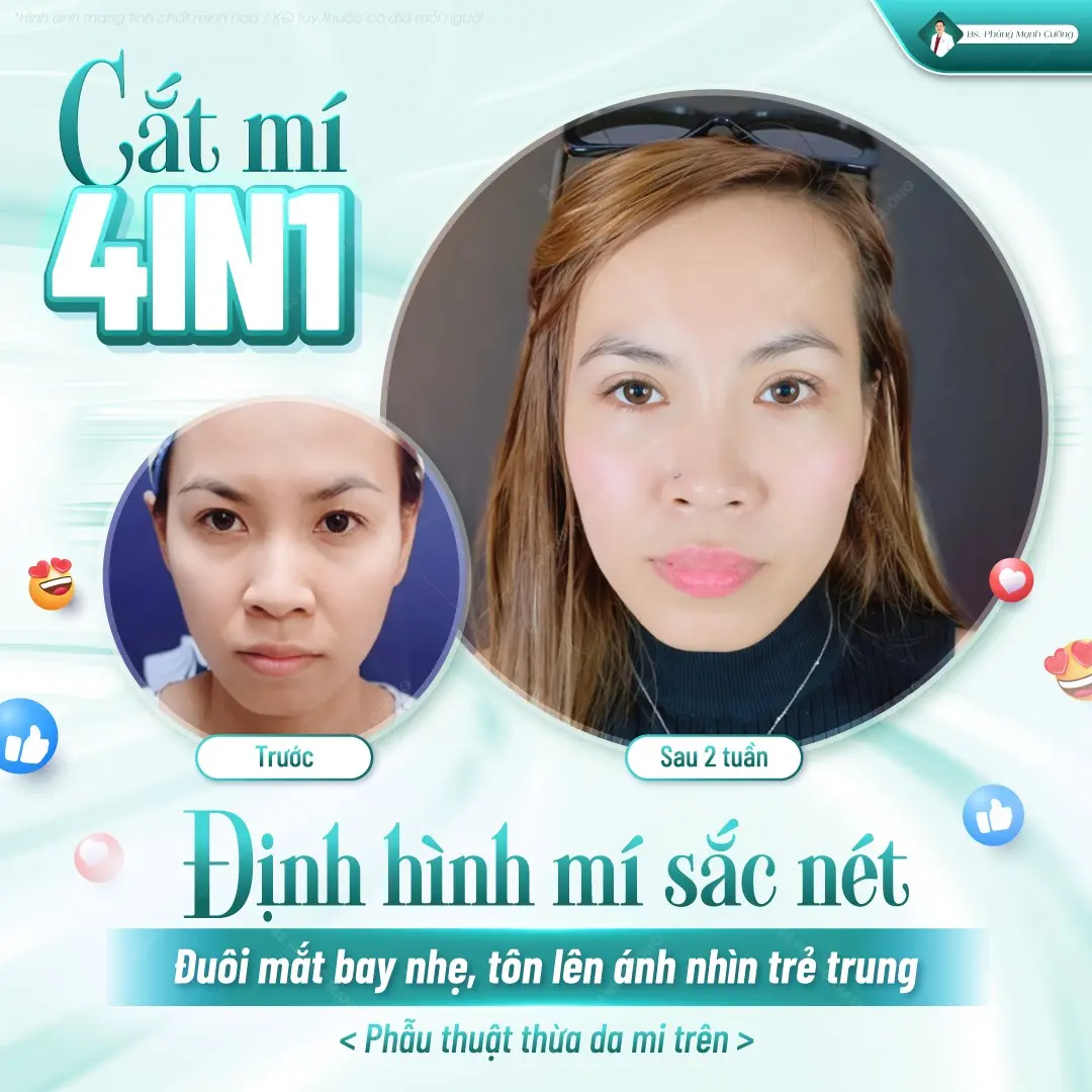 Tiêu chí lựa chọn địa chỉ cắt mí plasma uy tín