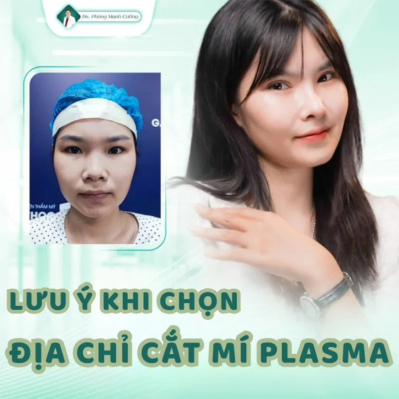 Cắt mí plasma giá bao nhiêu? Giá cắt mí plasma mới nhất 8 Lưu ý khi tìm hiểu giá cắt mí plasma và lựa chọn địa chỉ uy tín