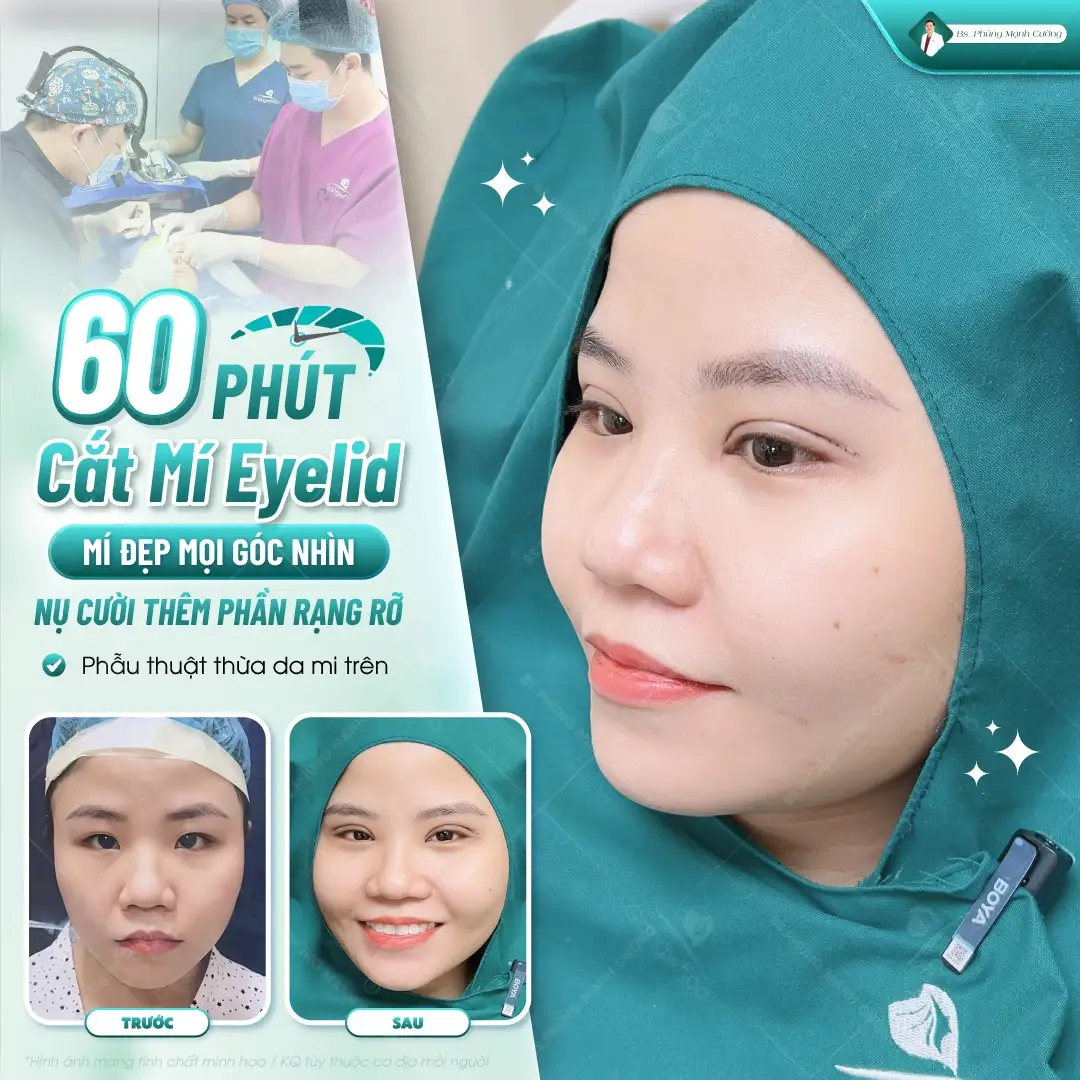 Tiêu chuẩn cắt mí thế nào là đẹp? Bác sĩ giải đáp chi tiết 12 Tuân thủ chăm sóc hậu phẫu để mí mắt vào form đẹp