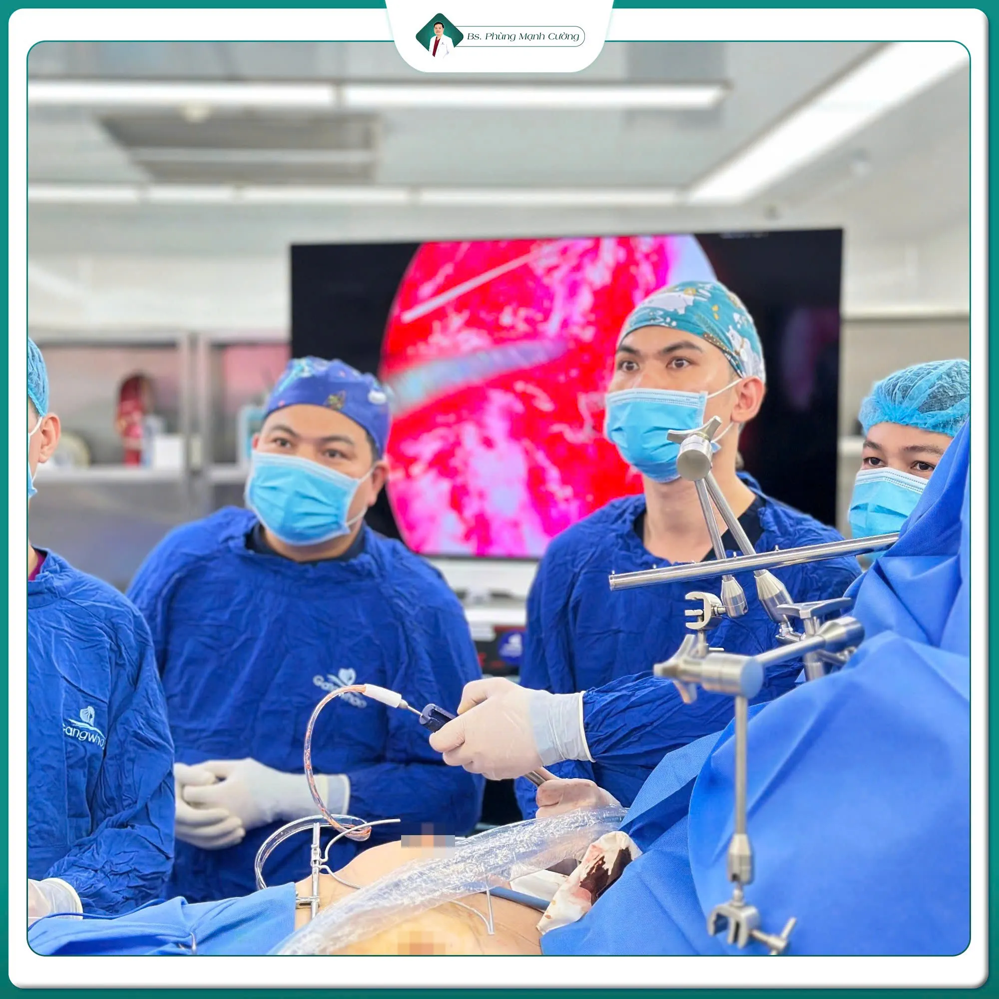 Cắt mí plasma giá bao nhiêu? Giá cắt mí plasma mới nhất 9 Địa chỉ cắt mí plasma đảm bảo vô trùng, an toàn