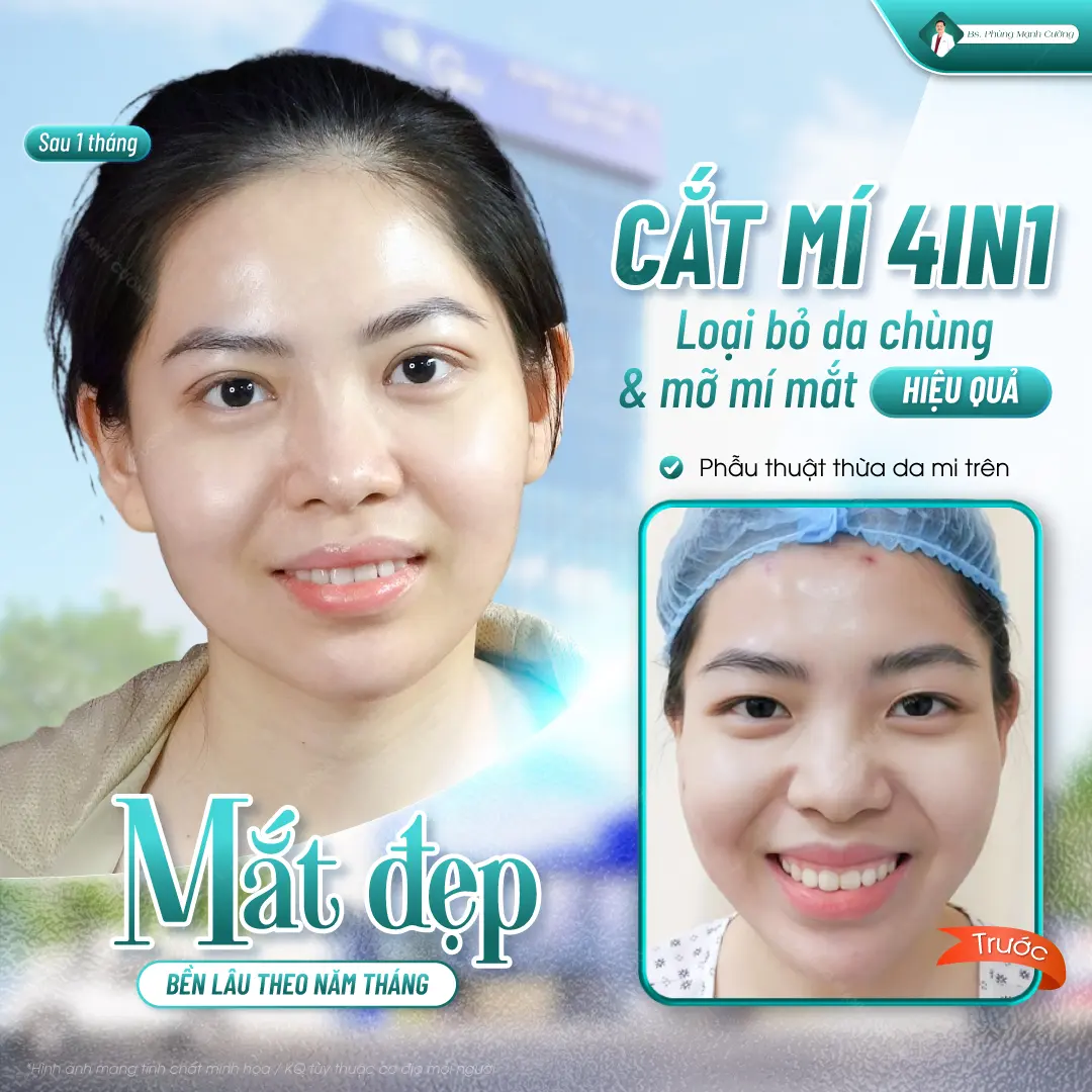 Tiêu chí lựa chọn địa chỉ cắt mí plasma uy tín