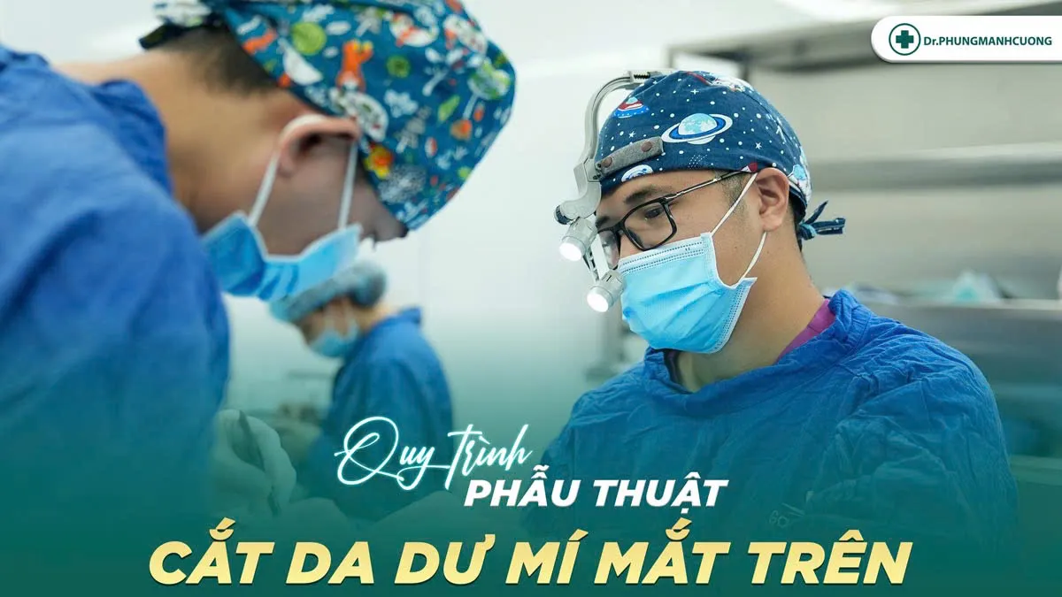 Cắt da dư mí mắt trên là gì? Có nên cắt da mỡ thừa mí trên? 9 Quy trình cắt da thừa mí trên an toàn chuẩn y khoa