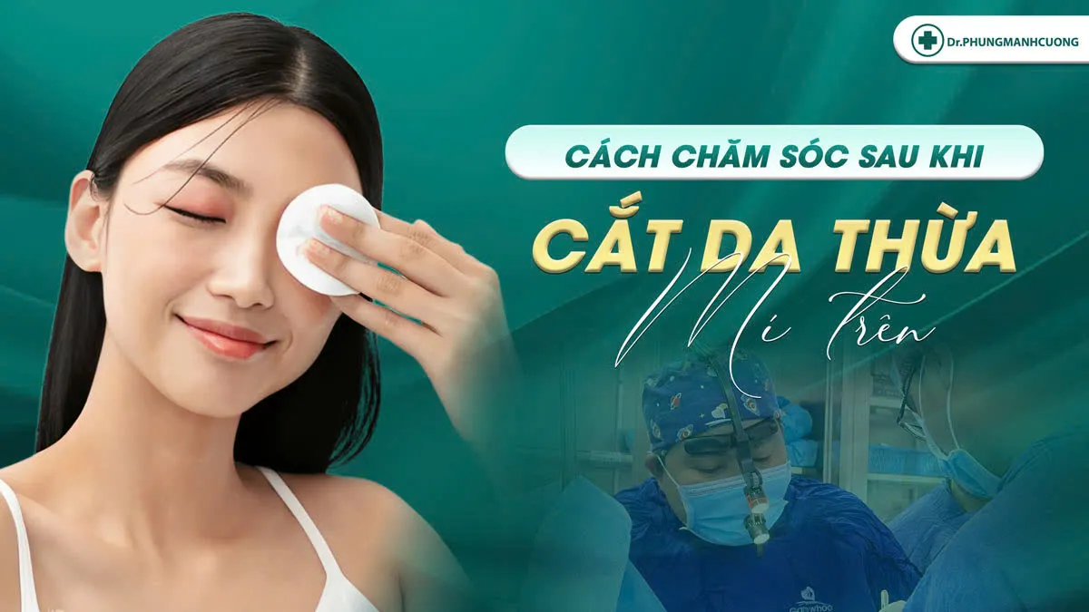 Cắt da dư mí mắt trên là gì? Có nên cắt da mỡ thừa mí trên? 10 Hướng dẫn chăm sóc sau khi cắt da dư mí mắt trên