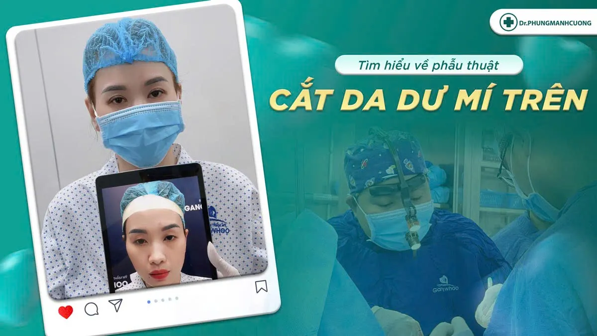 Cắt Da Dư Mí Trên: Giải Pháp Cho Đôi Mắt Tươi Trẻ

Phẫu thuật cắt da dư mí mắt trên loại bỏ da chùng...