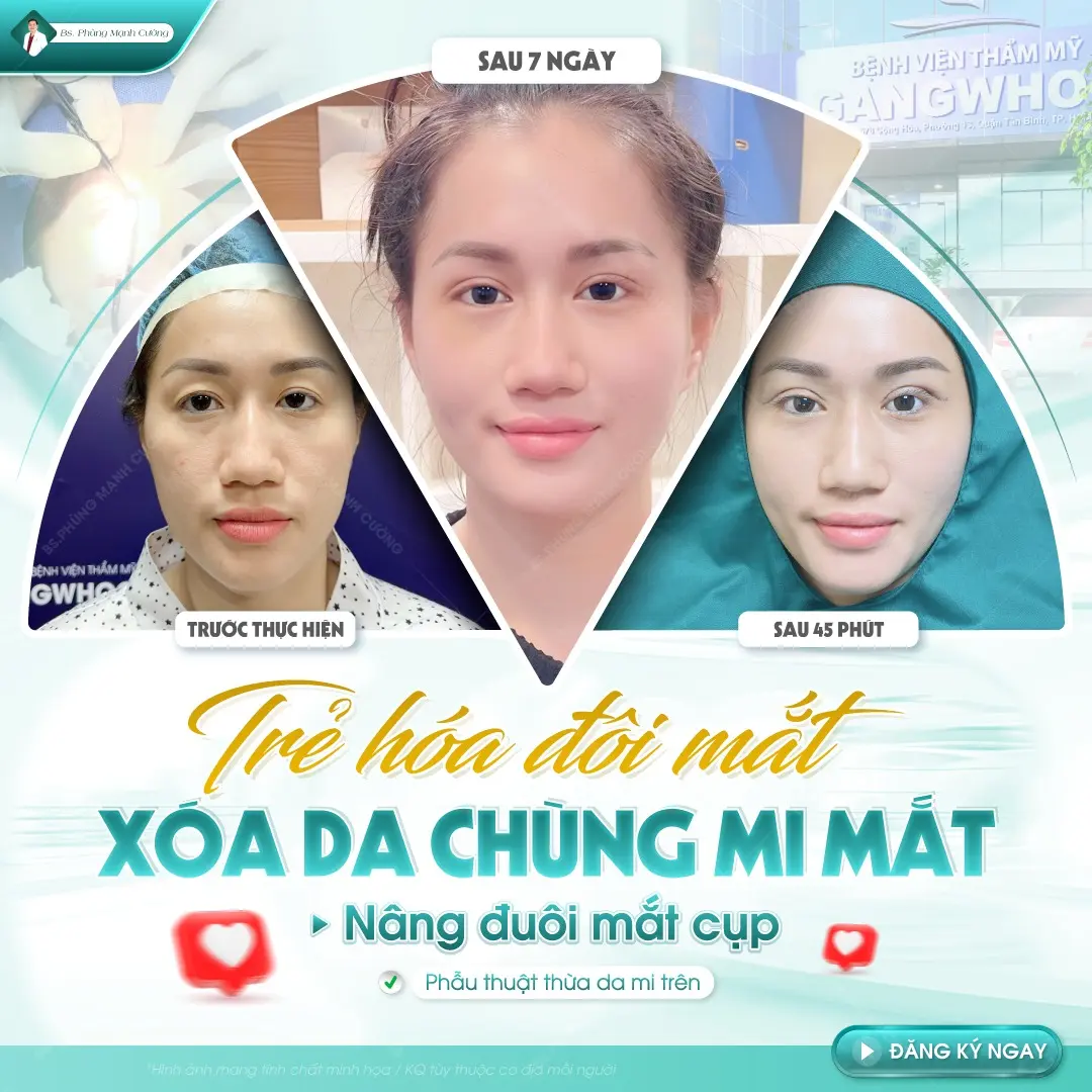 Các yếu tố ảnh hưởng đến chi phí cắt da thừa mí mắt