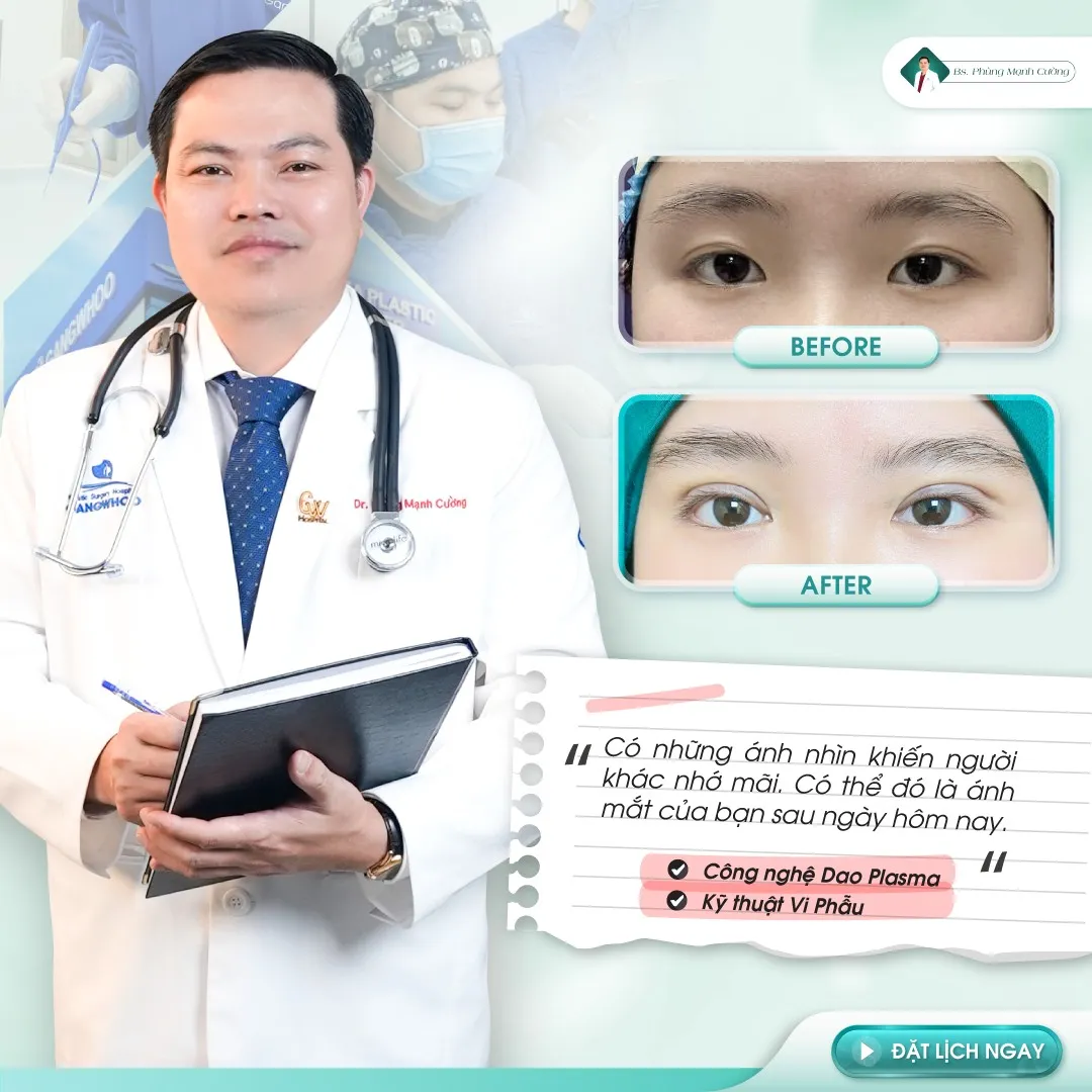 Cắt da thừa mí mắt tại cơ sở của Bác sĩ Phùng Mạnh Cường - chuyên gia gần 20 năm kinh nghiệm